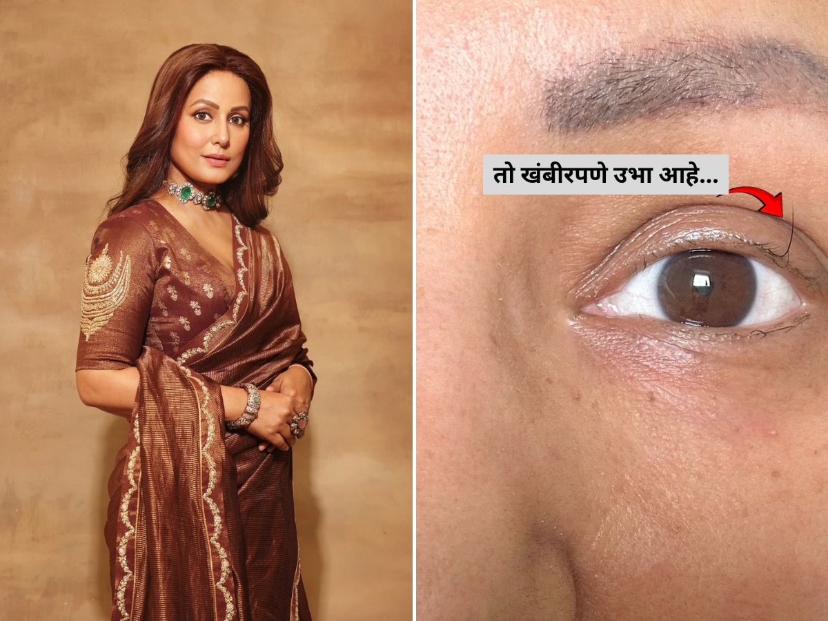 Hina Khan shares pic of her last standing eyelash amid cancer treatment; कॅन्सरशी लढणाऱ्या Hina Khan ने पोस्ट केला फोटो; पापणीत उरला एकच केस…